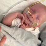 A Baby Is Healed Using Gene-Editing Tech